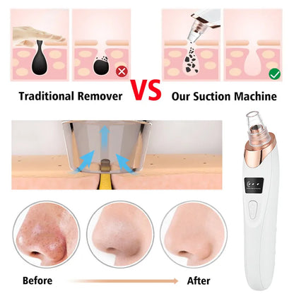 DearBeauty Vacuum - Vista Echo